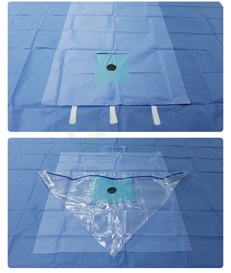 High absorbent 130gsm SMPE fabric as reinforced part for surgical drape - YuChen