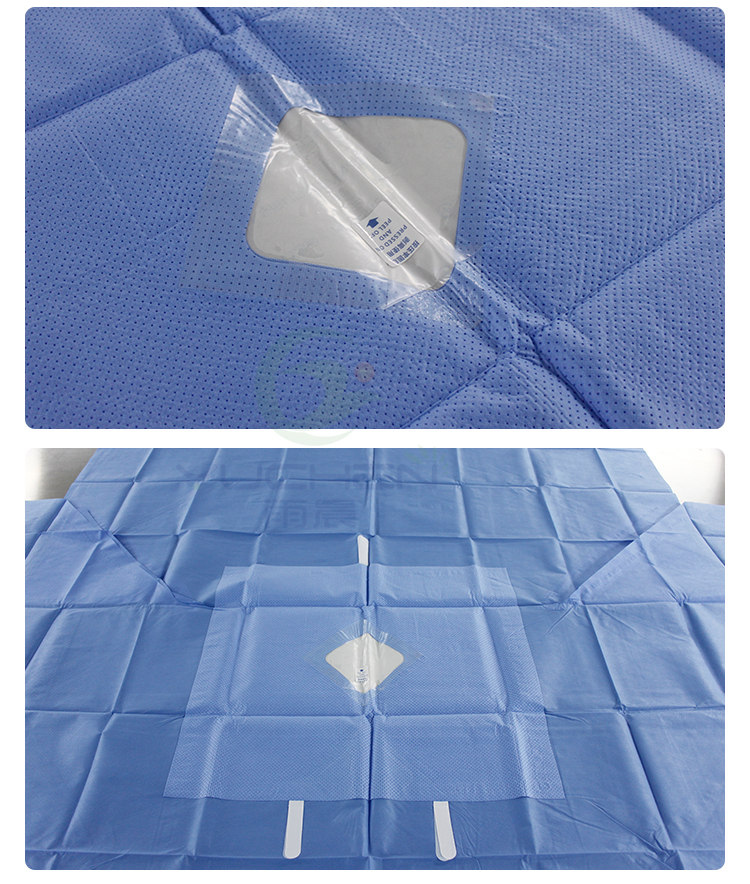 High absorbent 130gsm SMPE fabric as reinforced part for surgical drape - YuChen