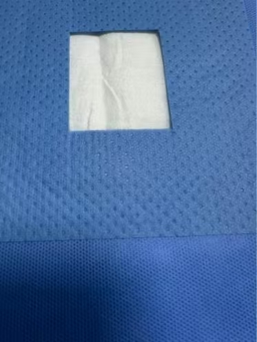 Disposable Surgical Drape - YuChen
